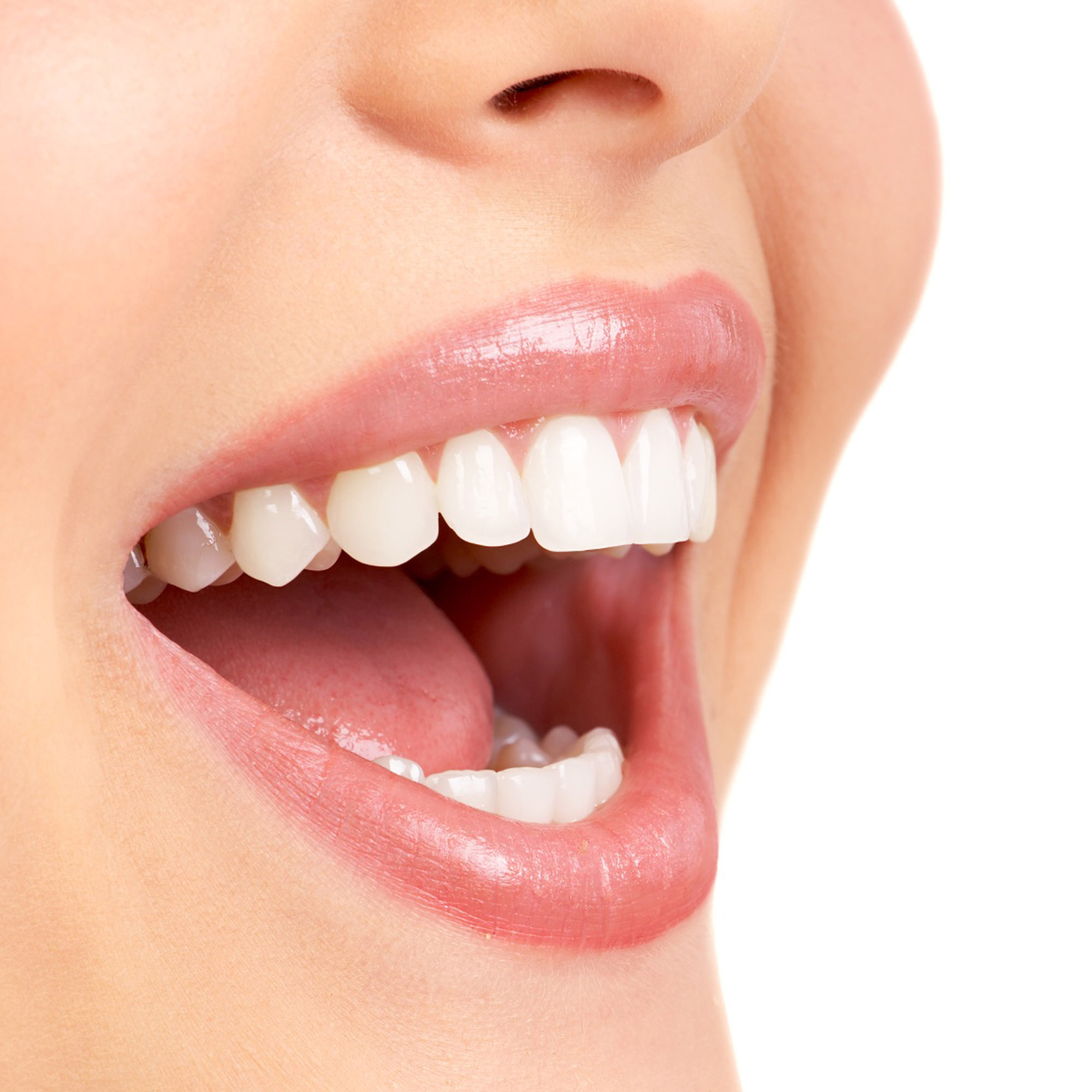 RĂNG SỨ THẨM MỸ